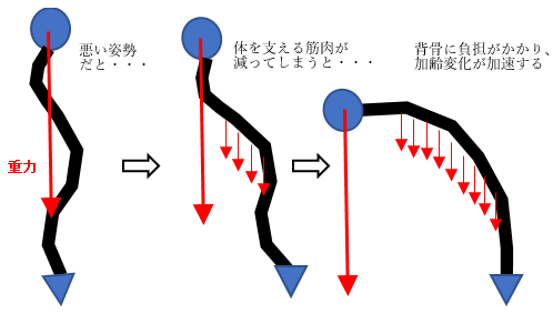 脊椎変性後側弯症 愛知医科大学病院