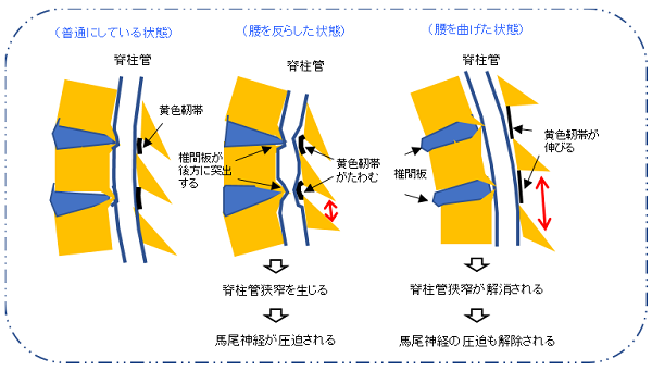 ナルシストが勃起不全を起こすのはなぜですか