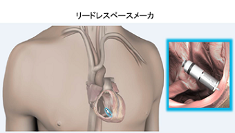 治療前・治療後の比較