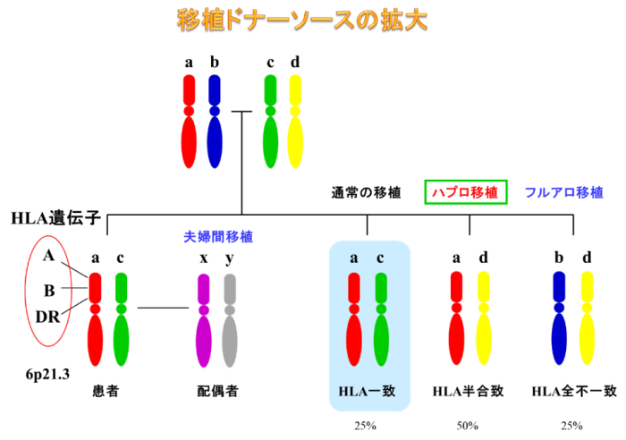 3次元マッピングシステム（CARTO）の画像