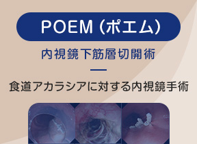 食道アカラシアに対するPOEM治療